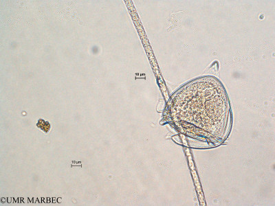 phyto/Scattered_Islands/all/COMMA April 2011/Phalacroma doryphorum (ancien Dinophysis sp3)(copy)_thumb.jpg